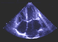 Cardiovascular Imaging and Clinical Research Core Laboratory Home Page